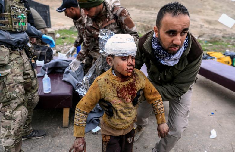 A boy injured in a mortar attack walks toward an ambulance after being treated by medics in a field clinic as Iraqi forces battle with Islamic State militants, in western Mosul. REUTERS/Zohra Bensemra